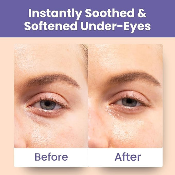 Patchology Skin Remedy Soothing Eye Gels